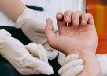 5 dau hieu tren tay bao hieu than suy an 3 den giup phuc hoi 2039.jpg