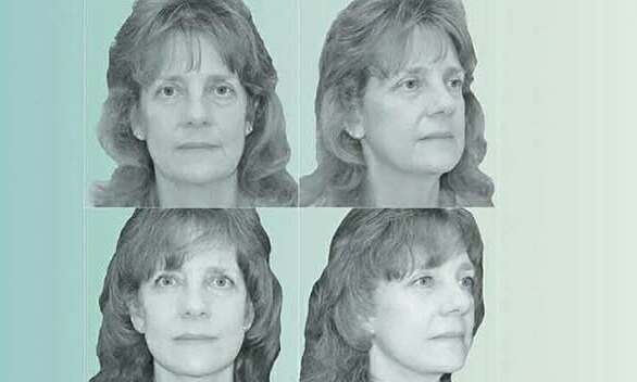 Mặt chảy xệ bởi 'thần dược' giảm cân 549820795 2969424786578167 239 1670 3278 1757978849.jpg