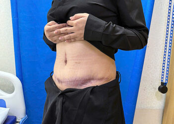 b4dc2fcf04e58fbbd6f4 175697687 9166 7862 1756976998.jpg