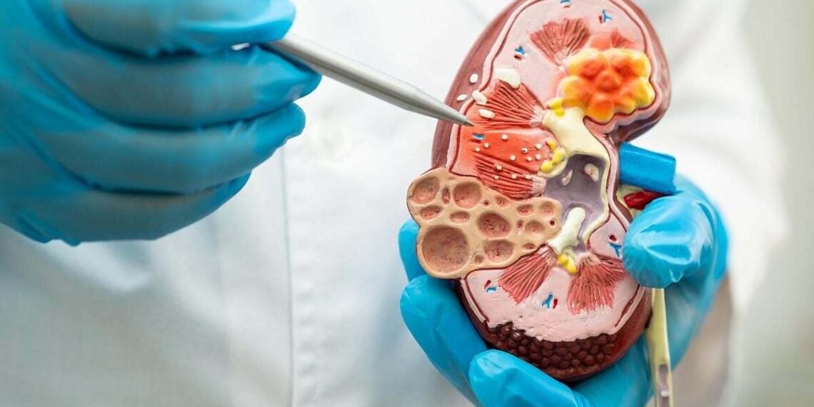 chronic kidney disease doctor 8837 8734 1757349504.jpg