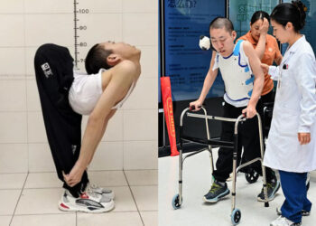 gaplung1 1756692046 2591 1756692338.jpg