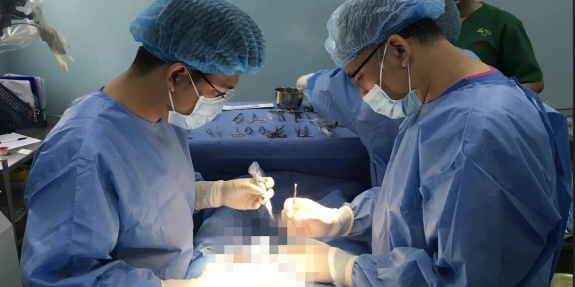 Tai nạn khi quan hệ tình dục: Chuyên gia nam khoa lên tiếng gay duong vat crop 1712764663711.jpeg