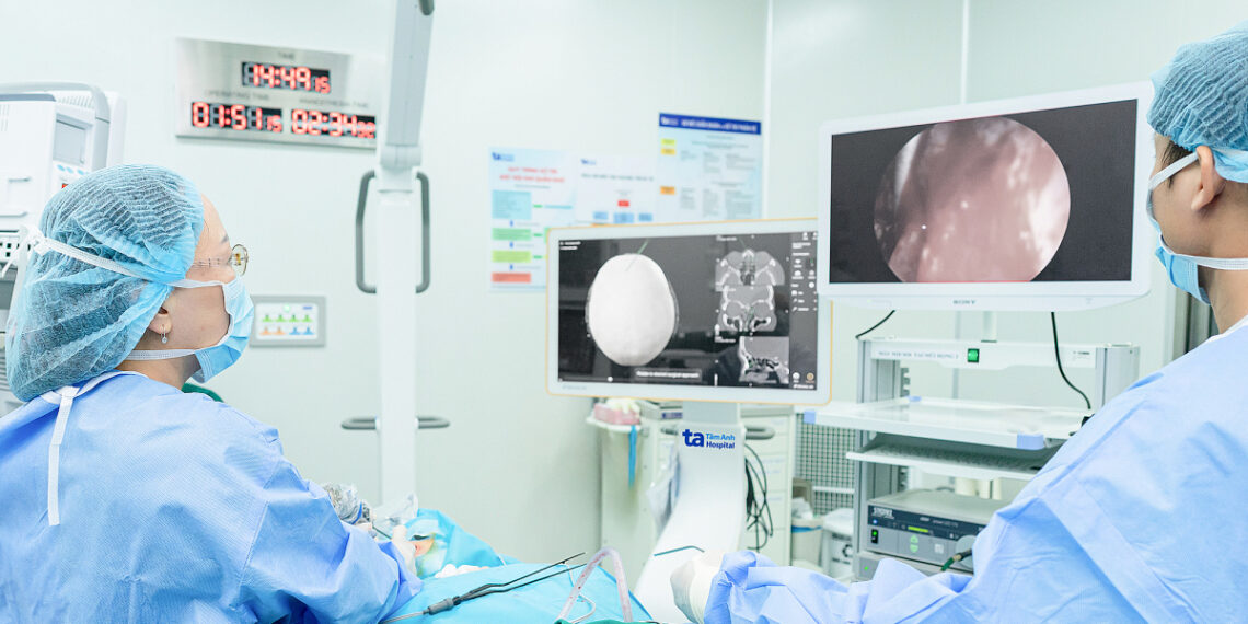 Mổ xoang trí tuệ nhân tạo khác nội soi thế nào hi nh 10 1 1756597179 17565971 6094 8266 1756597408.jpg