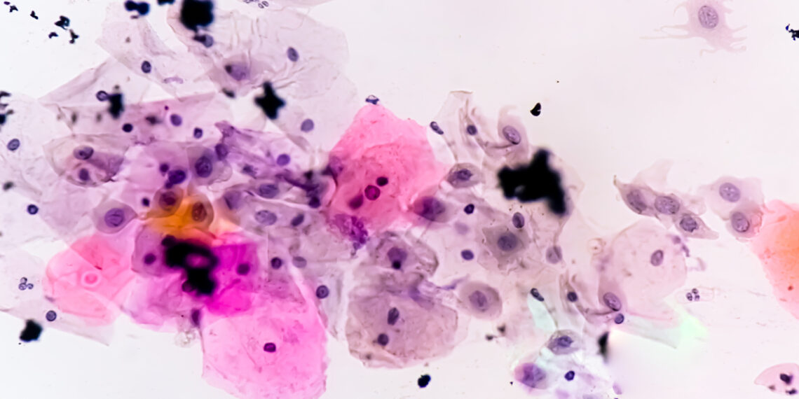medium vecteezy paps smear ana 3553 6311 1750926571.jpg