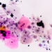 medium vecteezy paps smear ana 3553 6311 1750926571.jpg