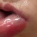 Người phụ nữ môi trề như cá trê sau tiêm meso làm đẹp moi sung crop crop 1721096870894.jpeg