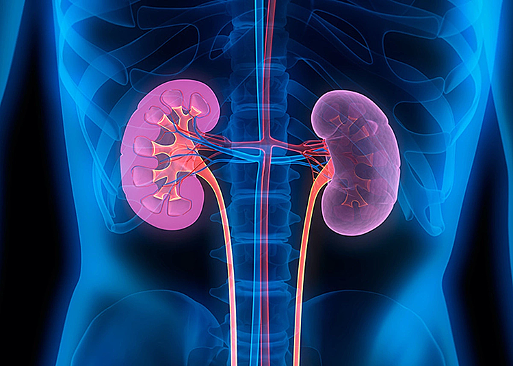 Vỡ thận do chủ quan với sỏi news kidneys illustration 1740 6451 2457 1756730848.png
