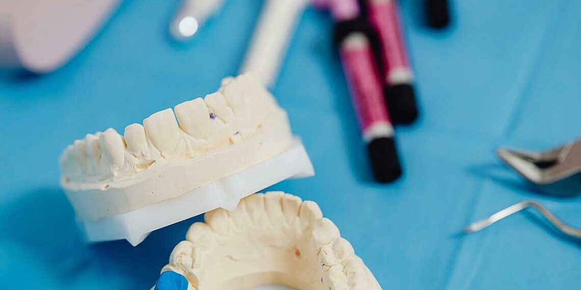 Tự mua nhựa trám răng, người đàn ông bị dính chặt khoang miệng pexels karolina grabowska 6627 6441 7614 1756891437.jpg