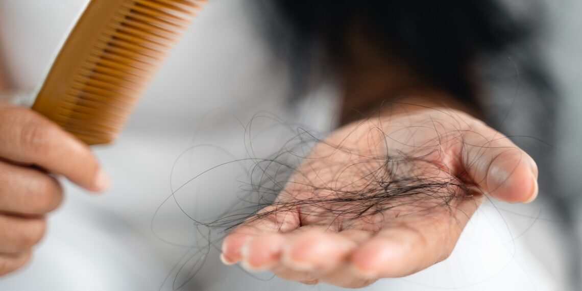 rung toc sau mac sot xuat huye 1189 4591 1757662936.jpg