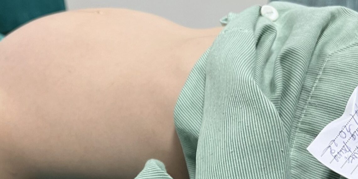 Bé gái 12 tuổi đi khám vì bụng to bất thường ubuongtrung1 crop 1668178307957.jpeg