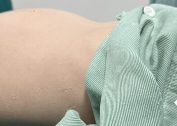 ubuongtrung1 crop 1668178307957.jpeg