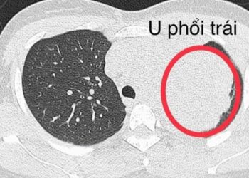 ungthuphoi crop 1712547228982.jpeg