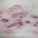 vet mun rop zona than kinh 175 3458 4075 1757133233.jpg