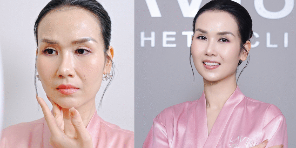 vht b a 1753427417 1753427430 1573 1753427695.png