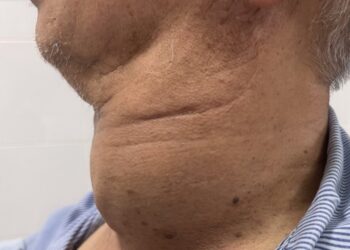 z392313239189799bbbdb355af9f4e14d66338431ab933 crop 1669854588550.jpeg