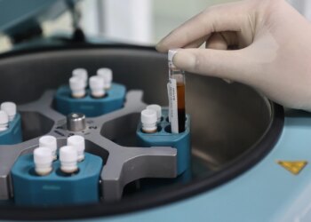 Tiền đái tháo đường làm tăng nguy cơ gan nhiễm mỡ 1761595865 233a1820 1761395095 3830 1761395338.jpg