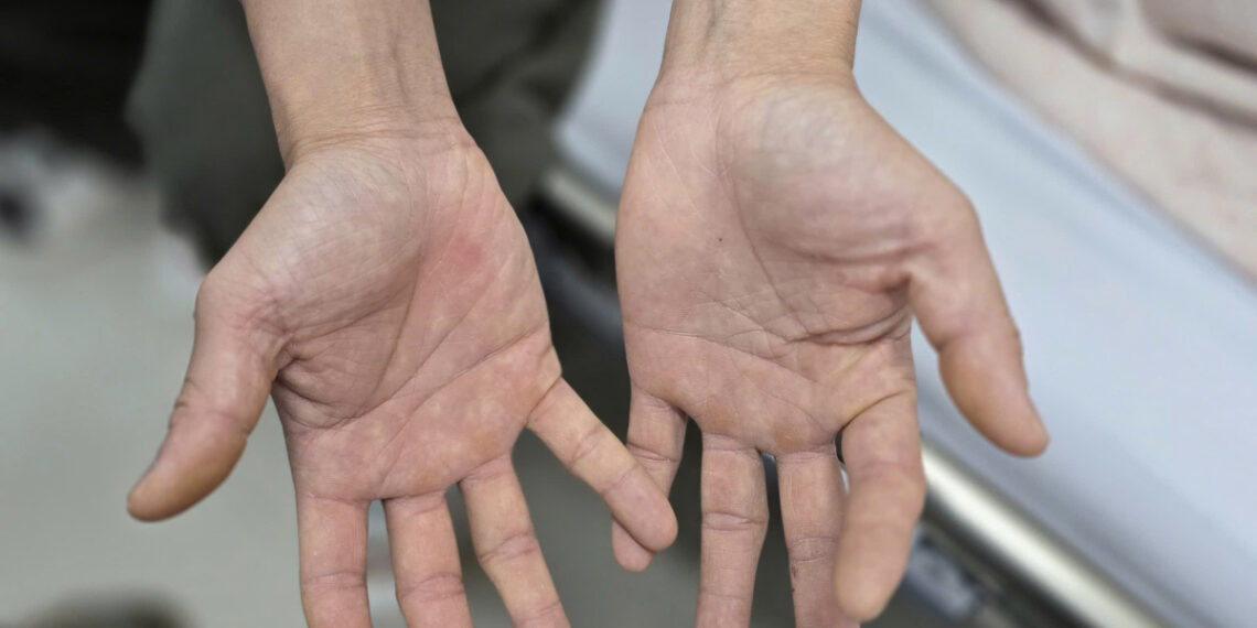 Cuộc sống bên bờ vực của cặp vợ chồng nghiện bóng cười 2 1761639544 1761639670 6029 1761639716.jpg