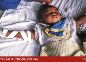 Gia tăng số ca mắc tả tại hơn 30 quốc gia, WHO cảnh báo về nguy cơ lan rộng ca 1110nid cholera peru online 27901091380579591937793 14285786534666153239887.jpg