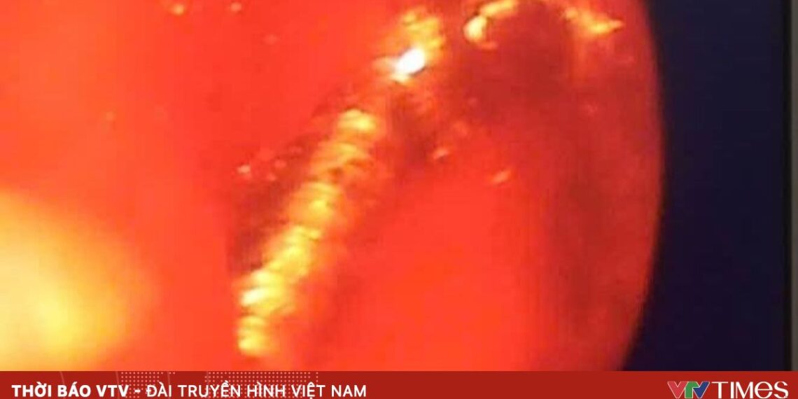 dinh vit 82732403091047297556836 51168801751206163576491.jpg