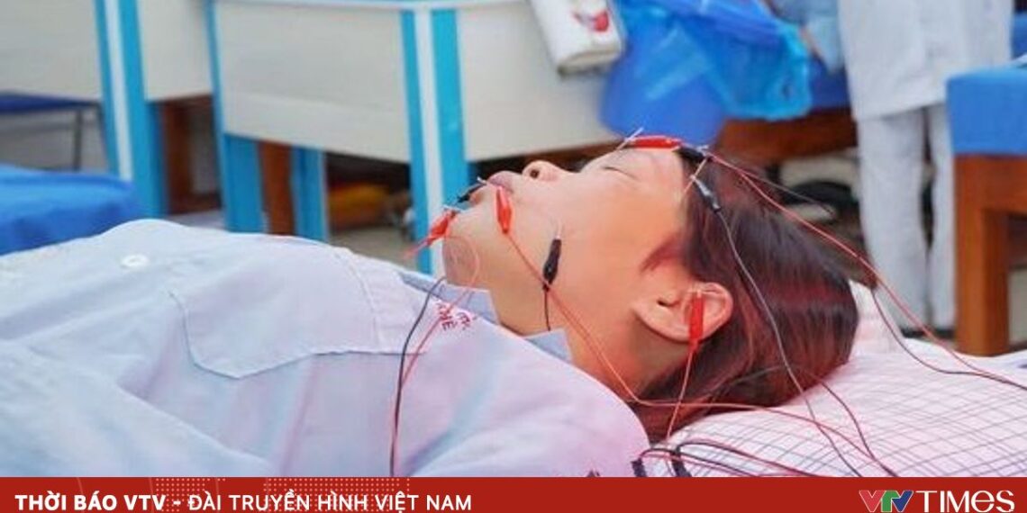 Liên tiếp 6 ca liệt mặt do lạnh nhập viện tại Phú Thọ liet day than kinh 52298629525909142852432 97893547983165565622029.jpg