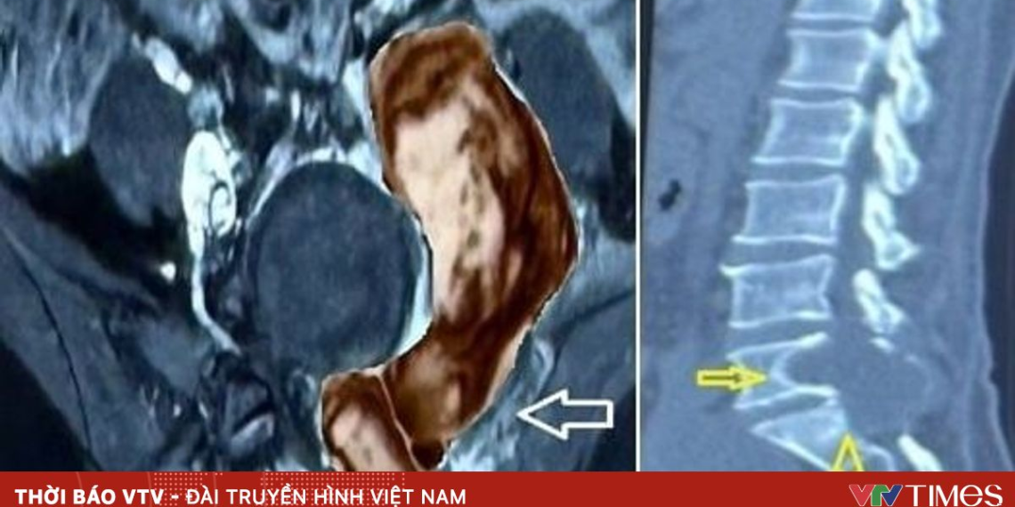 package media 24258462455414462499494 03884063272876063164539.png