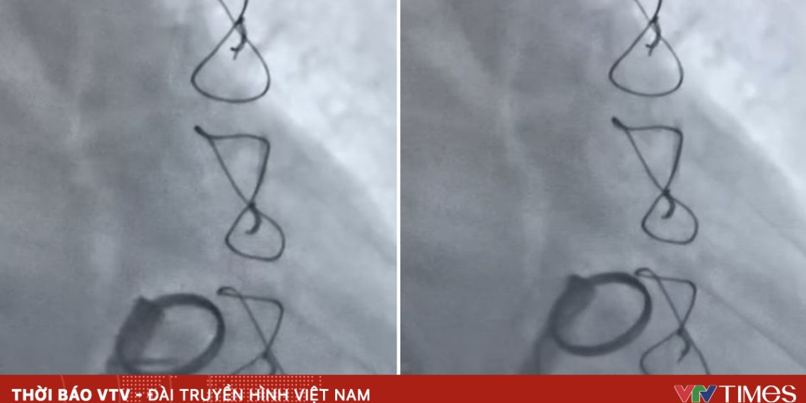 package media 70195607106499855787278 31124095062319301830914.png