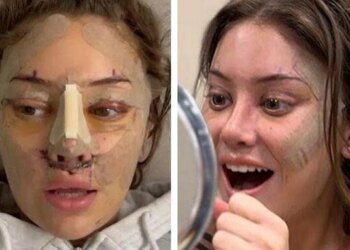 phau thuat 1760194272 17601943 6940 2698 1760196526.jpg