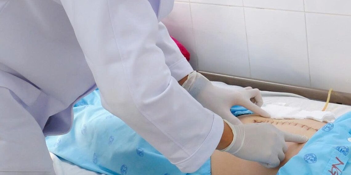 Cô gái khám định kỳ bất ngờ phát hiện ung thư đầu tụy phau thuat cho benh nhan 17593 4611 9362 1759307025.jpg
