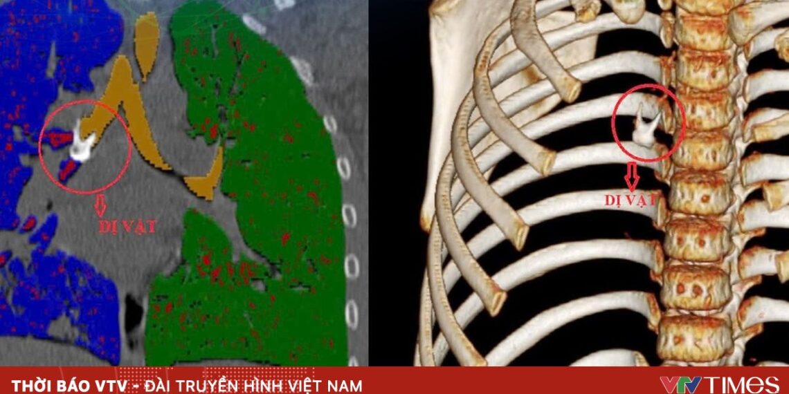 di vat rang 15729038375247658768892 77559645127568821931987.jpg