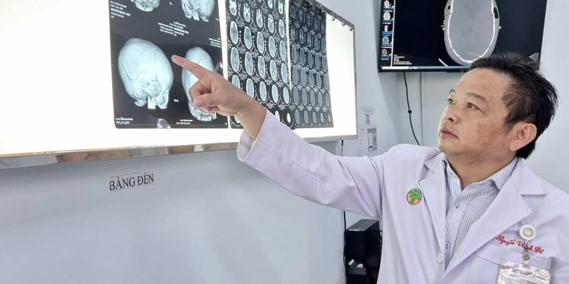 dinh khop so 1762074431 176207 4322 6949 1762127902.jpg