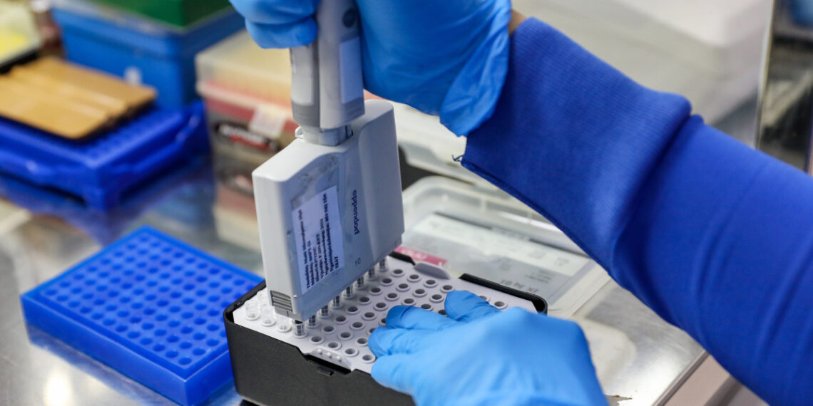 phongxetnghiem covid 19 72 176 9358 7150 1764234535.jpg