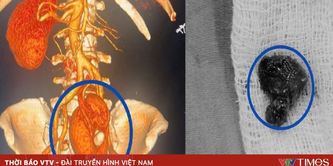 soi than 57760483024973965821318 24816217185960404558552.jpg