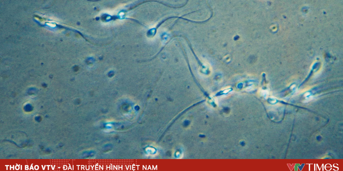 Ca mang thai đầu tiên trên thế giới nhờ phương pháp thu hồi tinh trùng do AI hỗ trợ tinh 43180232538370175551128 46625603407051122445078.png