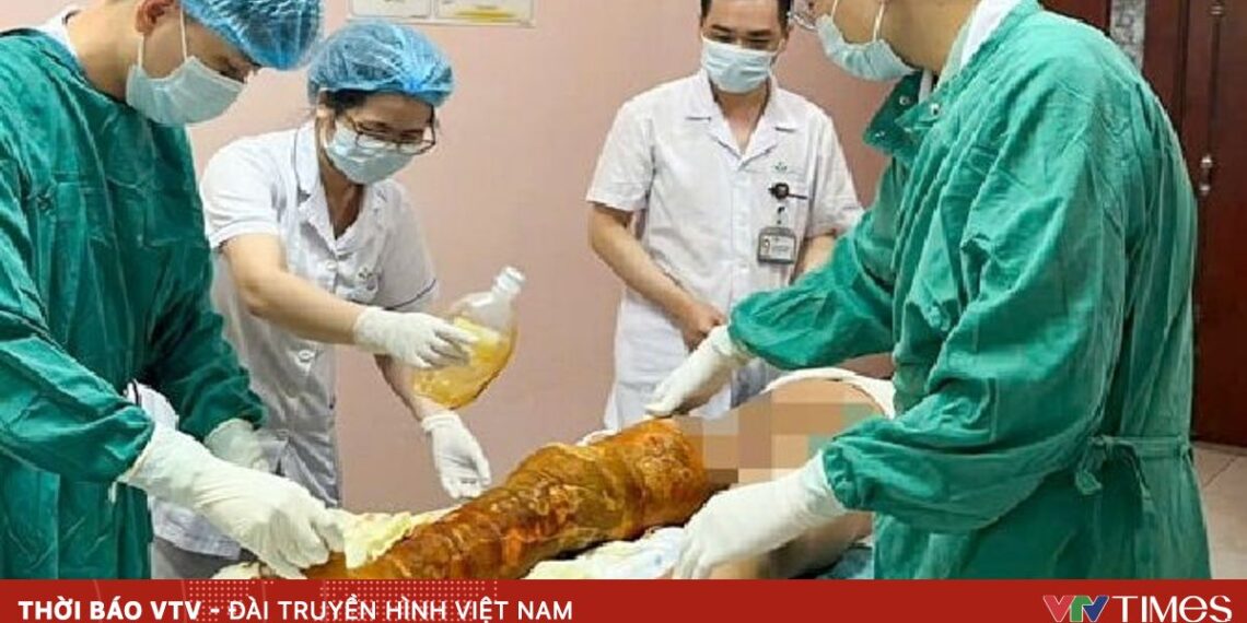 tre bong con 16777279410043320623527 59485940790491854709692.jpg