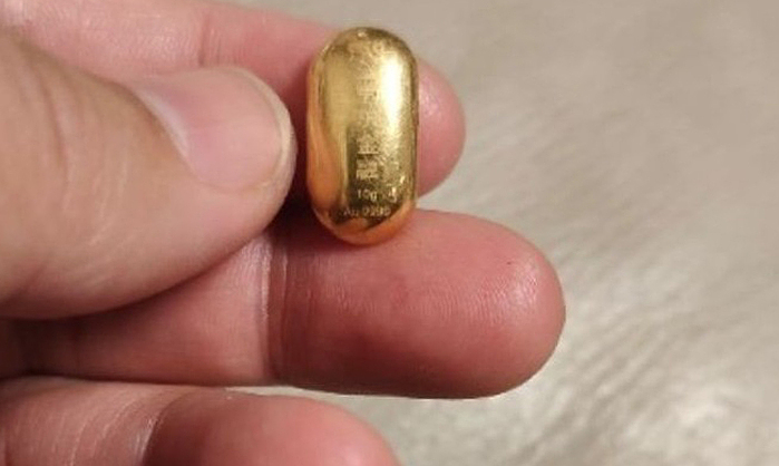 Bé trai 11 tuổi nuốt hạt đậu vàng 10 gram để 'rèn lưỡi' vang3 1761964570 1761964579 3809 1761965865.jpg