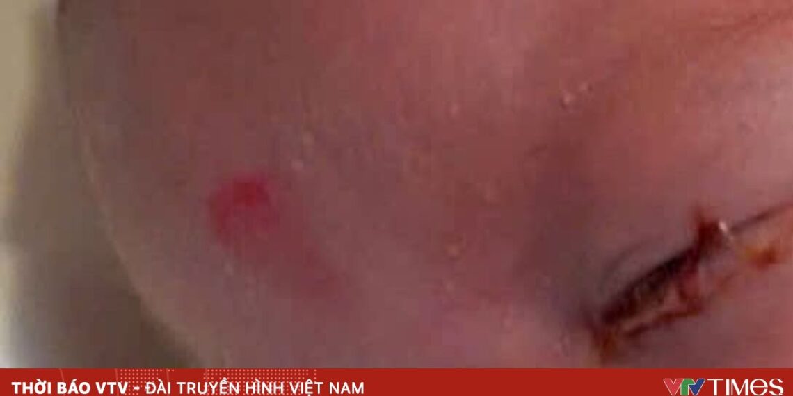 viem ket mac mat 92271377592520754290655 18037613682367529558119.jpg