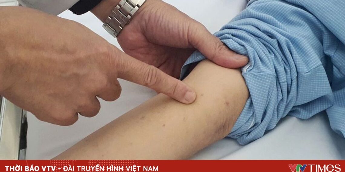 viem nao mo cau bv bach mai 28491567901087598437194 14113003635047445199666.jpg