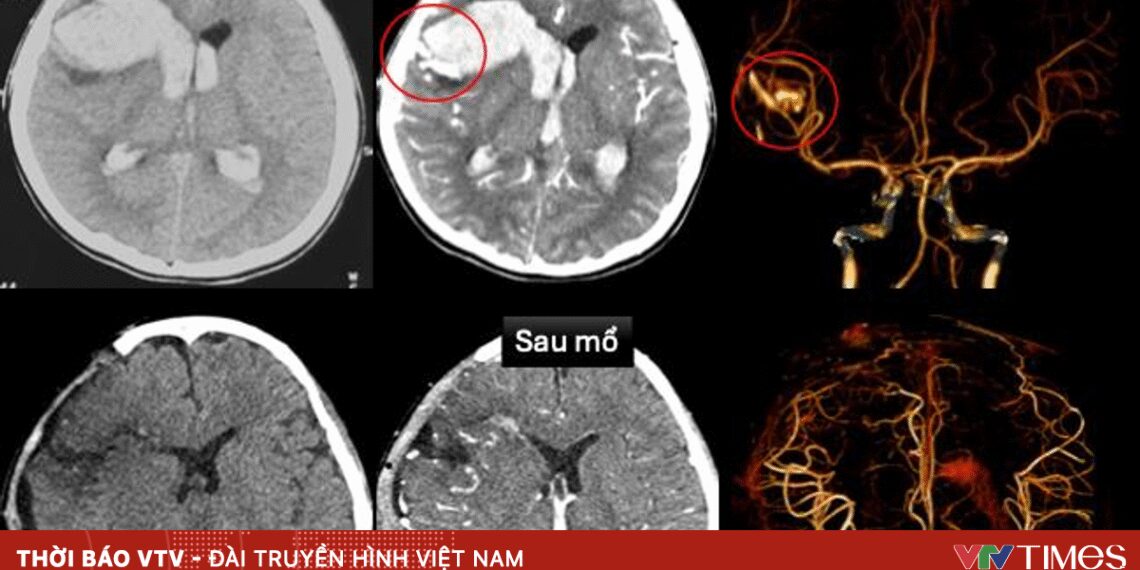 vo mach mau nao 47159779518225059977085 79296281931346041839374.jpg