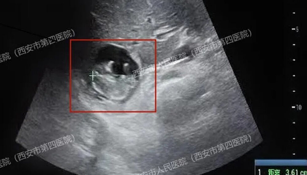 0 1765211342 1765211379 5158 1765211754.jpg