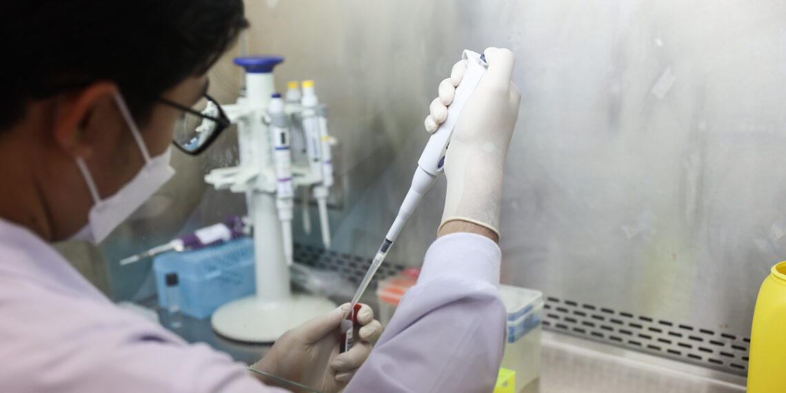 Khi nào mùi vùng kín nam giới báo hiệu bệnh? 233a1753 1765098767 7321 1765098794.jpg