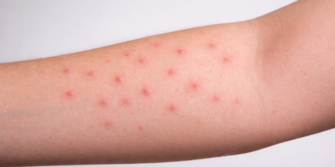 Dấu hiệu phổi tổn thương dễ nhìn thấy ở da, tay 92ab8de405f543439868cd8805bb05 3936 4293 1766389800.png