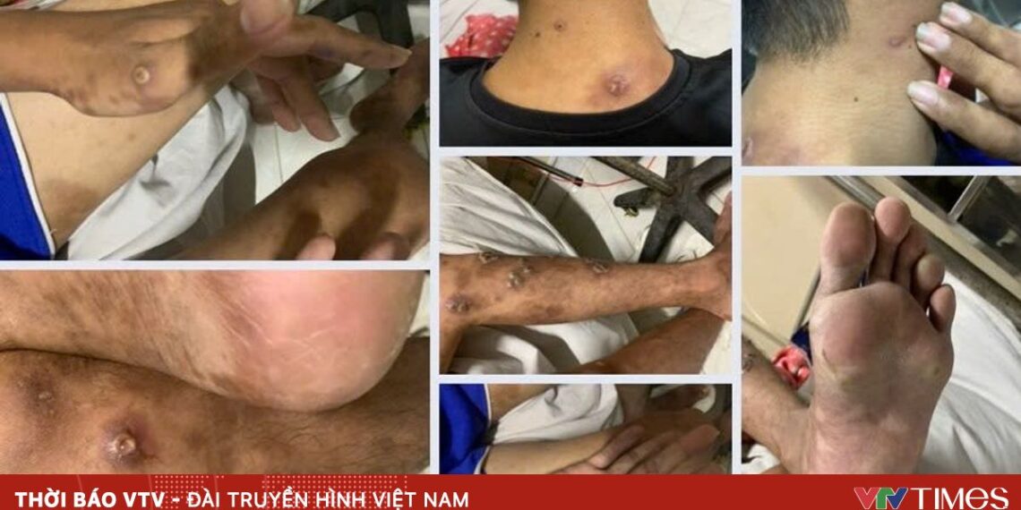 au mua khi ong nai 99207492288258727837604 19920370527247631283895.jpg