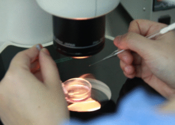 bac si viet giup nguoi dan ong my 70 tuoi triet san lau nam co con 571.png