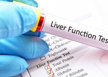 bon thay doi tren da canh bao benh gan 2525.jpg