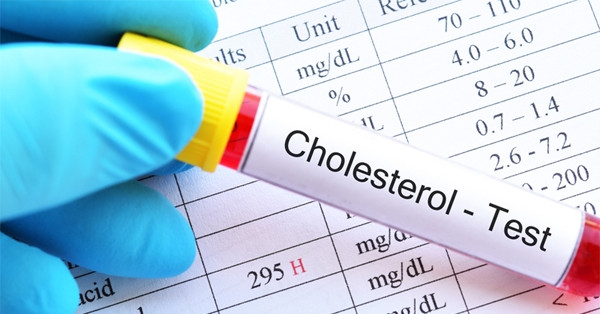 Hai dấu hiệu trên mặt cảnh báo mỡ máu cao hai dau hieu tren mat canh bao mo mau cao 1880.jpg