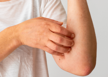 Dấu hiệu thầm lặng cảnh báo thận yếu nguada 1764574178 1764574195 6976 1764574199.png