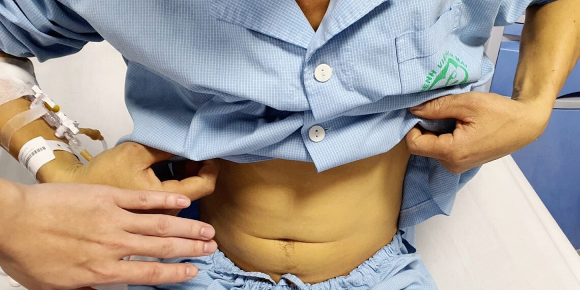 nguoi dan ong tre suyt tu vong vi uong mat ca tram de tang sinh luc 1076.jpg