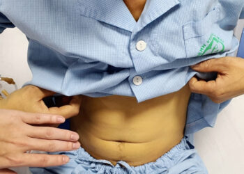 nguoi dan ong tre suyt tu vong vi uong mat ca tram de tang sinh luc 1076.jpg