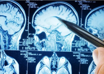 phat hien co khoi u nao nho canh bao cua dong ho deo tay 1722.jpg