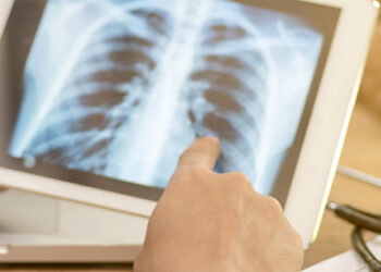 phat hien cung luc 2 loai ung thu tu trieu chung khi an 1652.jpg